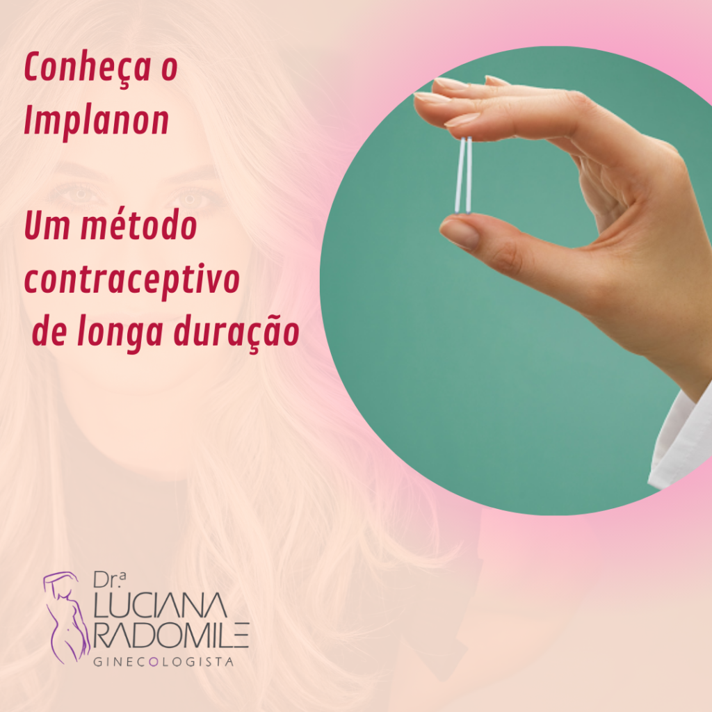 Conheça O Implanon Um Método Contraceptivos De Longa Duração Dra